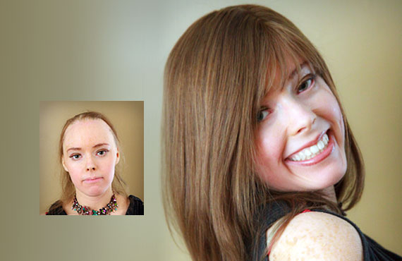 female hair loss solutions tupelo ms